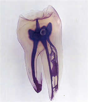 Root canal morphology and its relationship to endodontic procedures (FRANK J. VERTUCCI)Endodontic Topics 2005, 10, 3–29