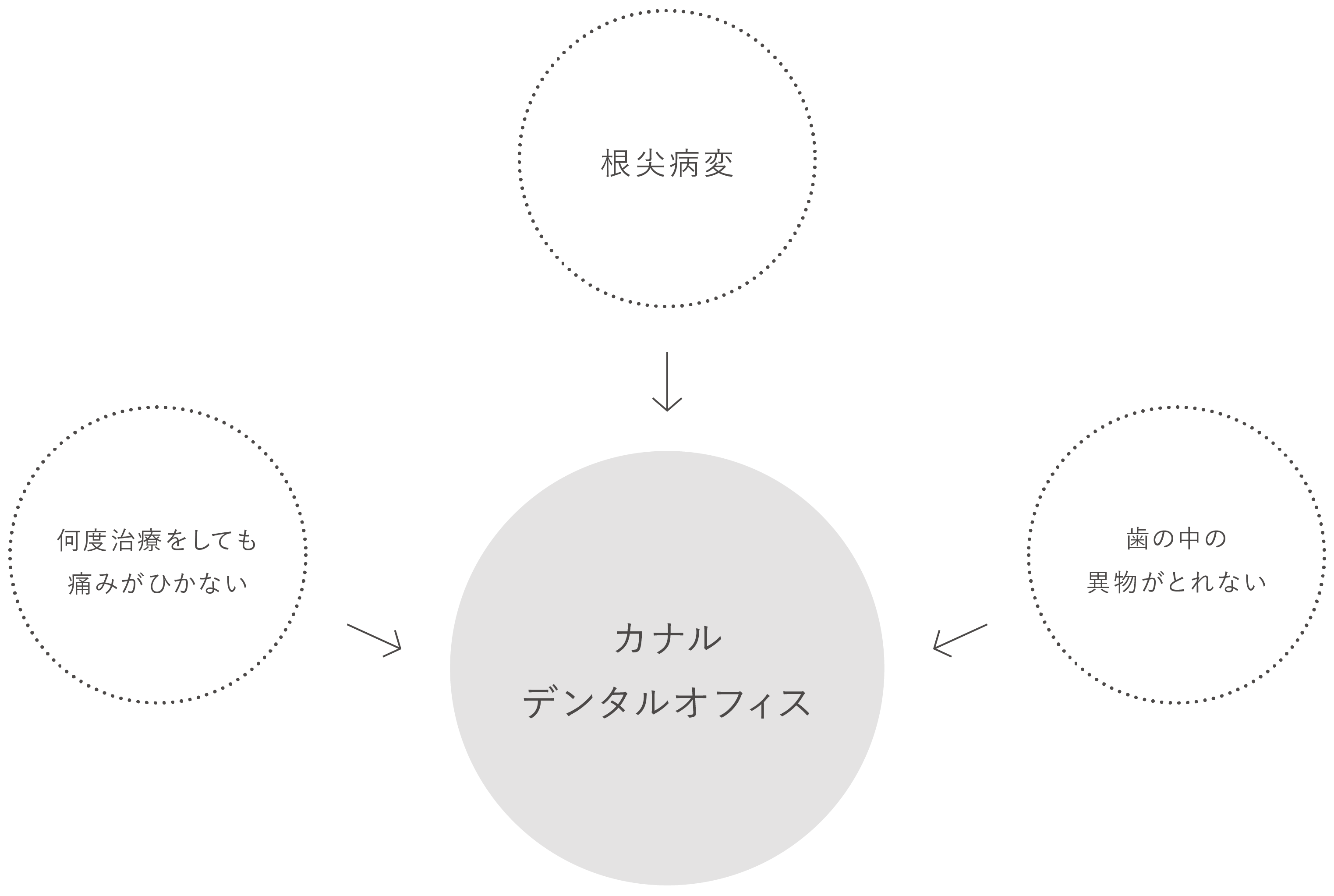 何度治療しても痛みがひかない｜骨がとけていて治療できない《歯周病の場合を除く》｜歯の中の異物が取れない